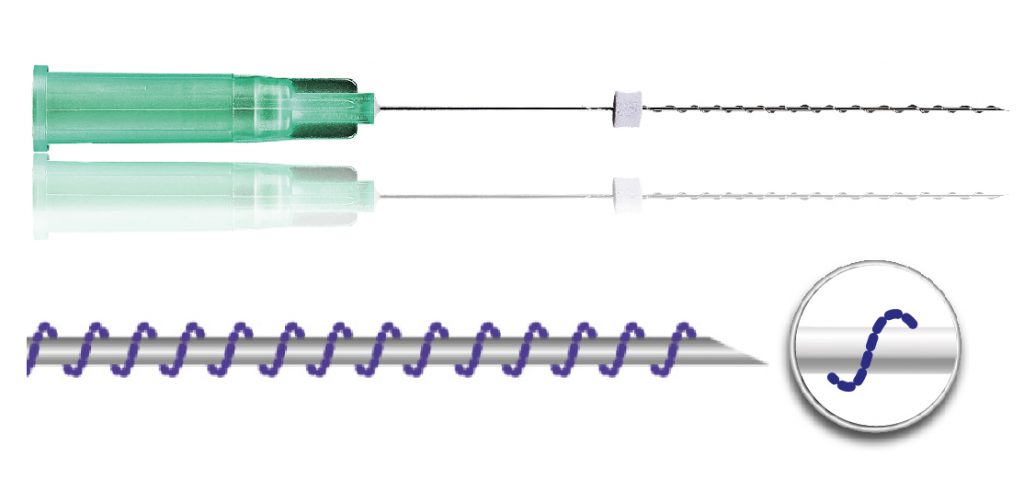 Volume-up-volume-up-screw-11-1024x491